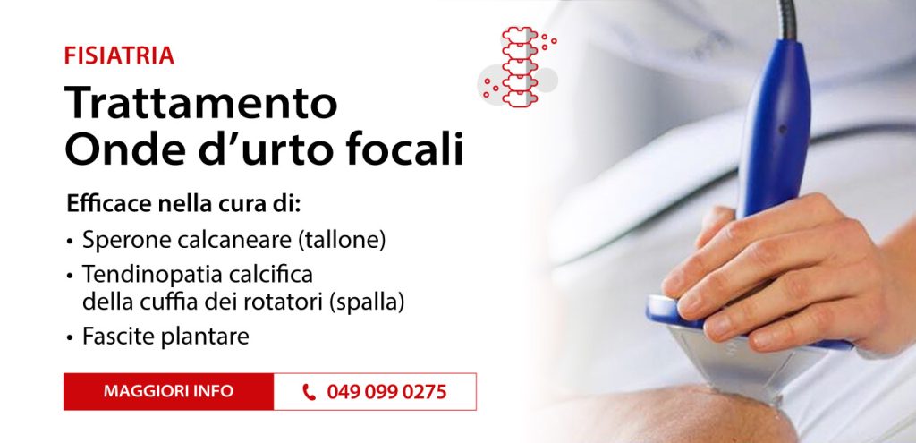 Fisiatria onde d'urto focali FIDAMedica